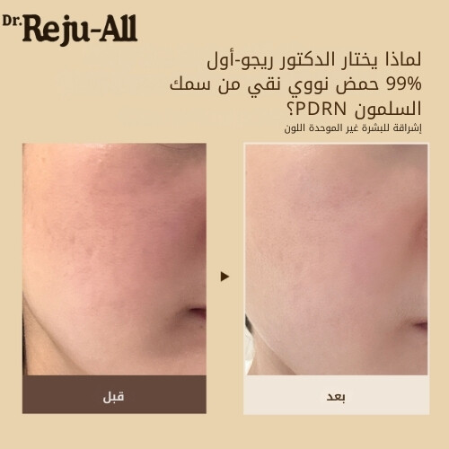 كريم PDRN المتطور لتجديد البشرة 20 مل