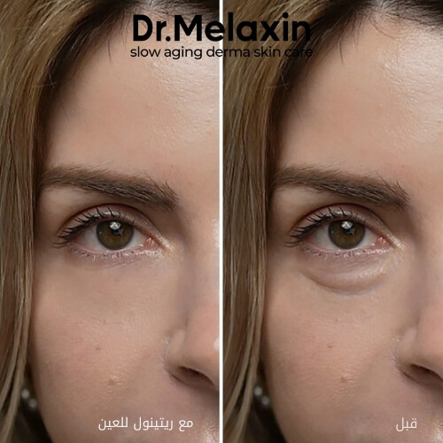 كريم إيفالت ريتينول للهالات السوداء 10 غرام