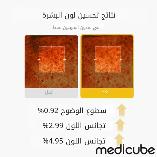 كريم كبسولات فيتامينات الكركم وحمض الكوجيك 53 غرام