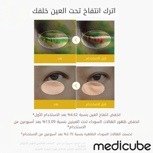 سيروم جل العين بفيتامينات الكركم وحمض الكوجيك 30 مل