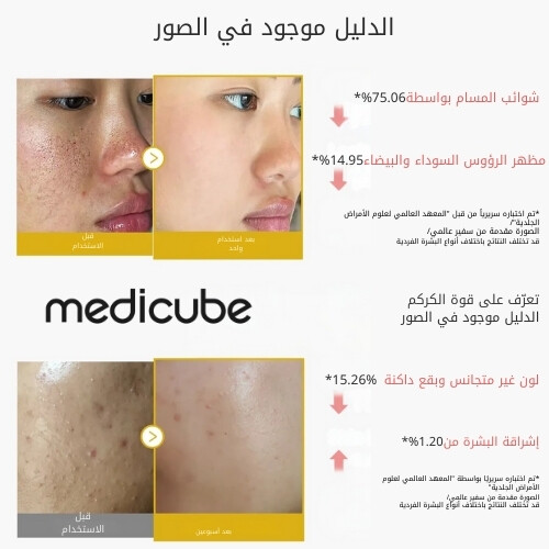 مقشر حمض الكوجيك والكركم  80 مل