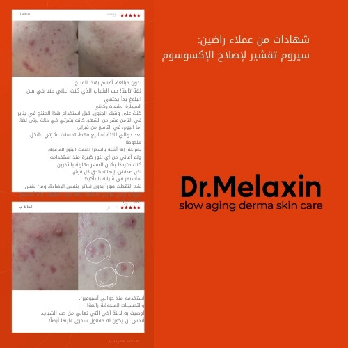 سيروم تقشير وإصلاح الإكسوسوم 50 مل