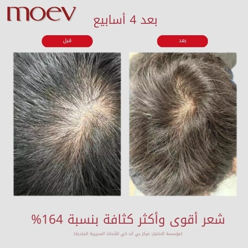 شامبو أنوركاتين 300 مل