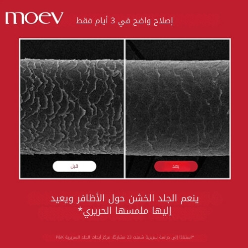 علاج أنوركاتين 200 مل