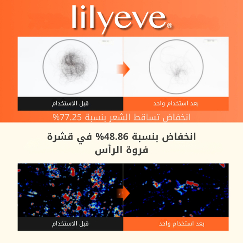 شامبو ليلييف جرو تيرن ثلاثي الأبعاد لزيادة كثافة الشعر 200 مل