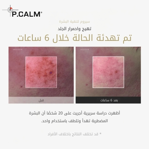 سيروم الثوم TXA 4 لتنقية البشرة 30 مل