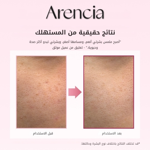 جرعة معززة من PDRN 30 مل