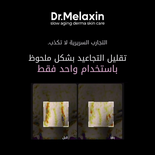 كريم شد البشرة من فيسفالت 50 غرام