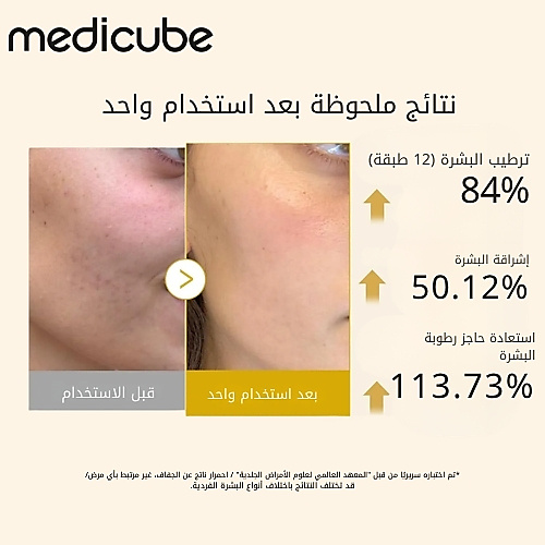 سيروم جل فيتامين بحمض الكوجيك والكمون 100 مل