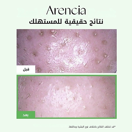 زيت تنظيف المسام موتشي 200 مل