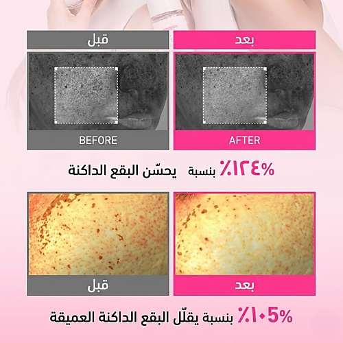 مجموعة معزز البشرة بحمض الترانيكساميك 100 مل