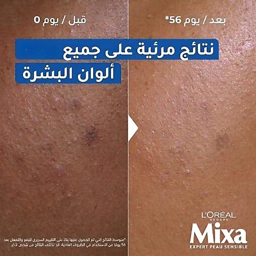 كريم ميكسا نياسيناميد لتصحيح الإشراقة - للوجه والجسم واليدين 400 مل