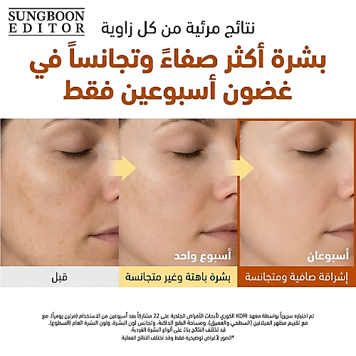 أمبولات تفتيح البشرة بحمض الكوجيك والنياسيناميد 40 مل