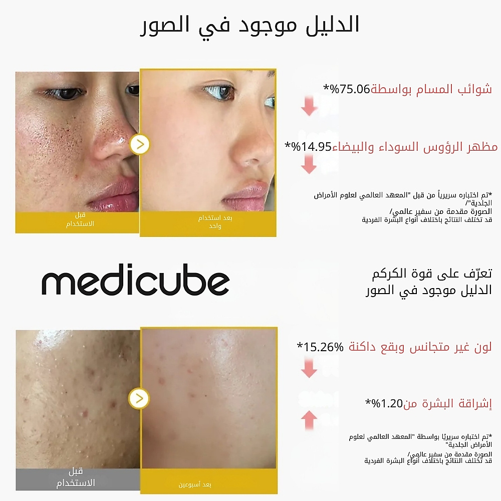 مقشر حمض الكوجيك والكركم  80 مل