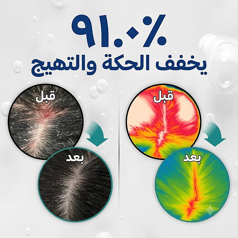 شامبو التنظيف العميق لفروة الرأس: تيرن سيكا بي دي آر إن ٥٠٠ غرام