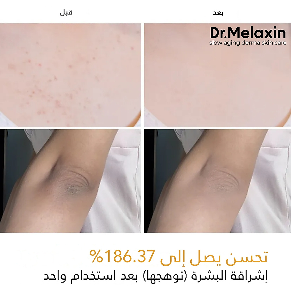 بخاخ التقشير بحمض الكوجيك والكركم من بيل شوت