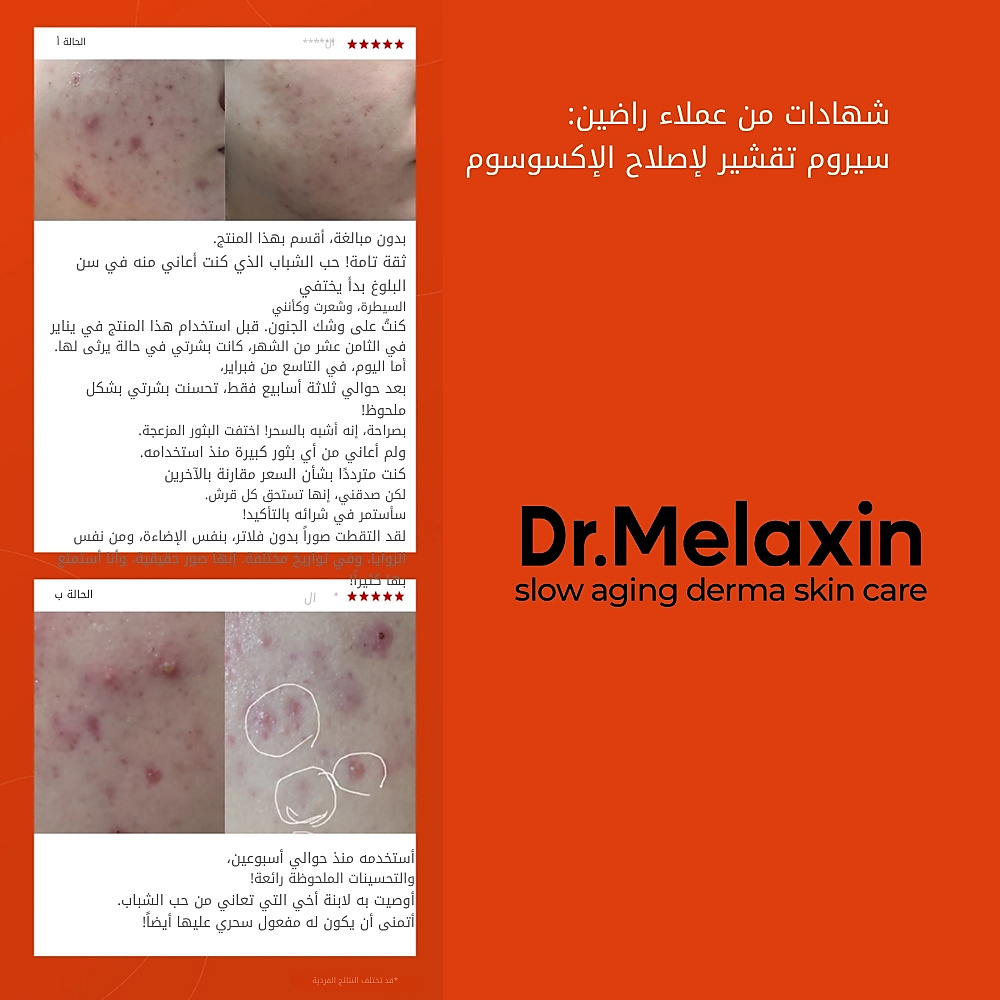 Exosome Repair Peeling Serum 50ml