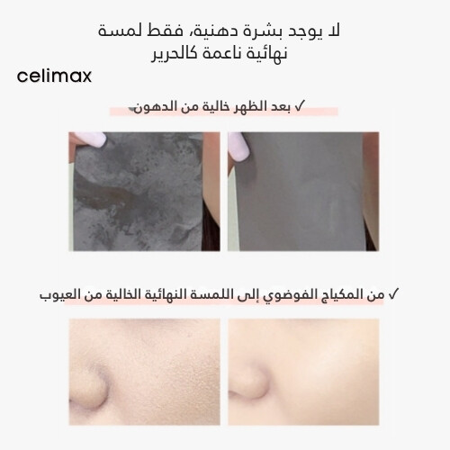 خلاصة كبسولة التحكم بالزيت 30 مل