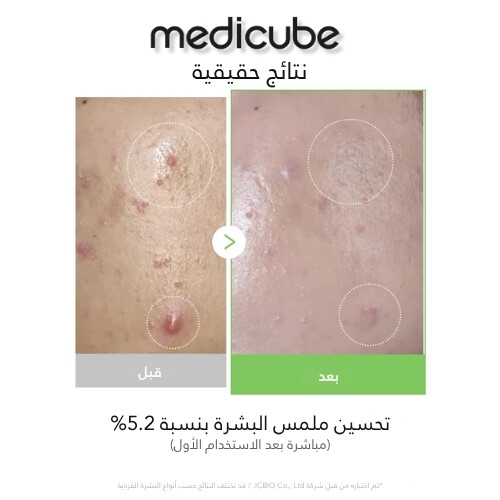 أمبولة إكسوسوم سيكا 30 مل