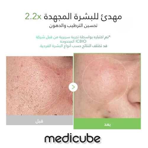 كريم إكسوسوم سيكا 50 مل