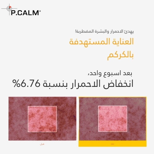 قناع الكركم العميق بفقاعات 90 مل