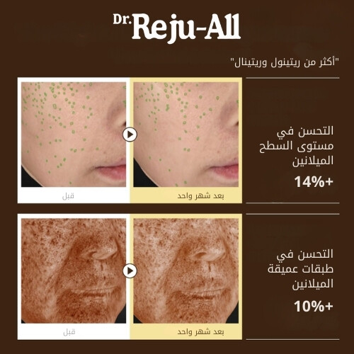 سيروم ريتينو ميلا المتقدم 30 مل