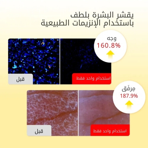 تونر فيتامين مضيء 150 مل