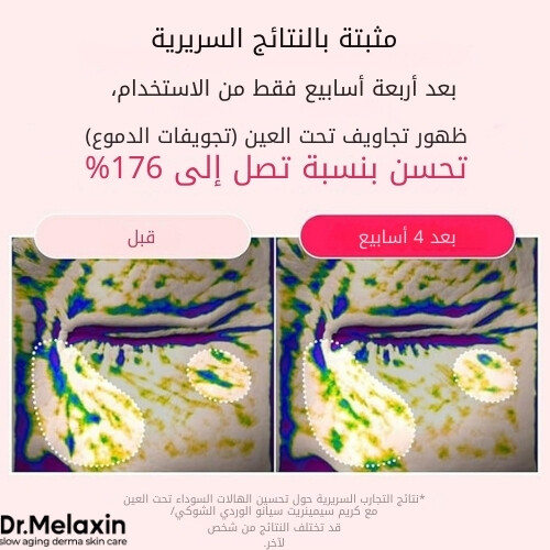 كريم سيمينريت سيانو الوردي ذو الشوائب 50 غرام