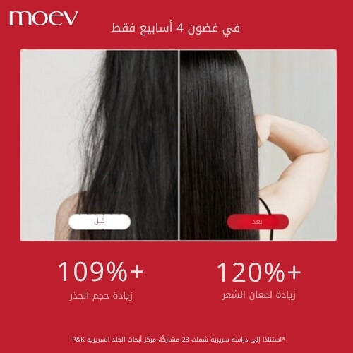 شامبو أنوركاتين 300 مل