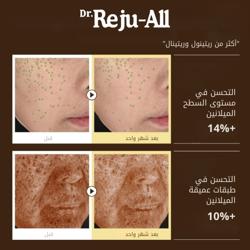 سيروم ريتينو ميلا المتقدم 5 مل