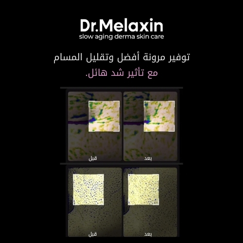 كريم شد البشرة من فيسفالت 50 غرام