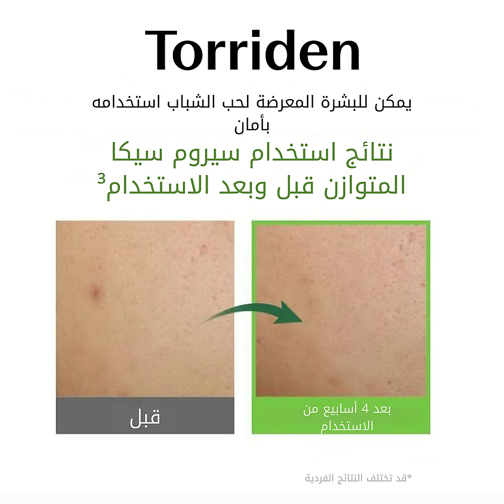 سيروم سيكا المتوازن 50 مل