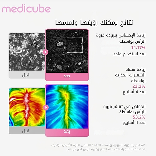 سيروم فروة الرأس روزيماري PDRN 20 مل