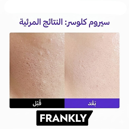 سيروم كلوزر لتضيق المسام 30 مل