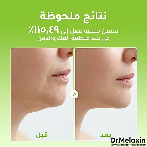 قناع رفع الذقن كاكتوس كولينق في اب (قطعة واحدة)