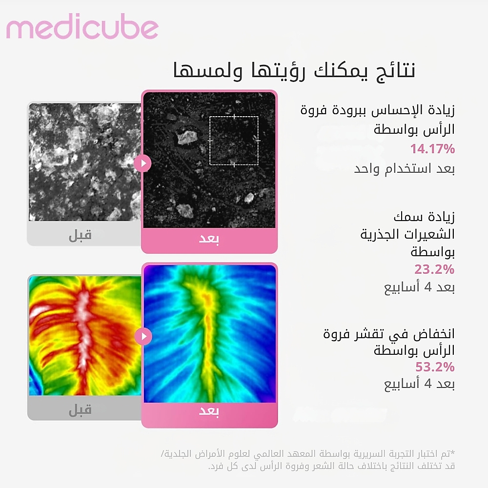 سيروم فروة الرأس روزيماري PDRN 20 مل