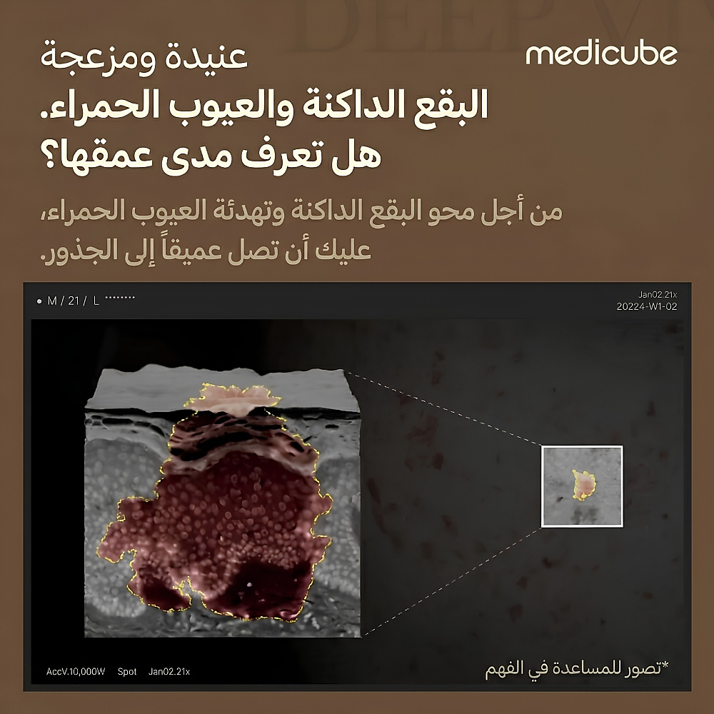 لصقات فيتامين سي العميق (6 قطع)