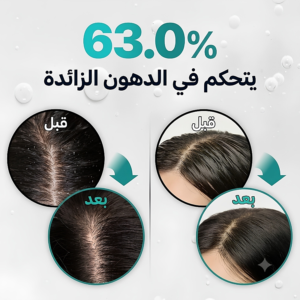 شامبو التنظيف العميق لفروة الرأس: تيرن سيكا بي دي آر إن ٥٠٠ غرام