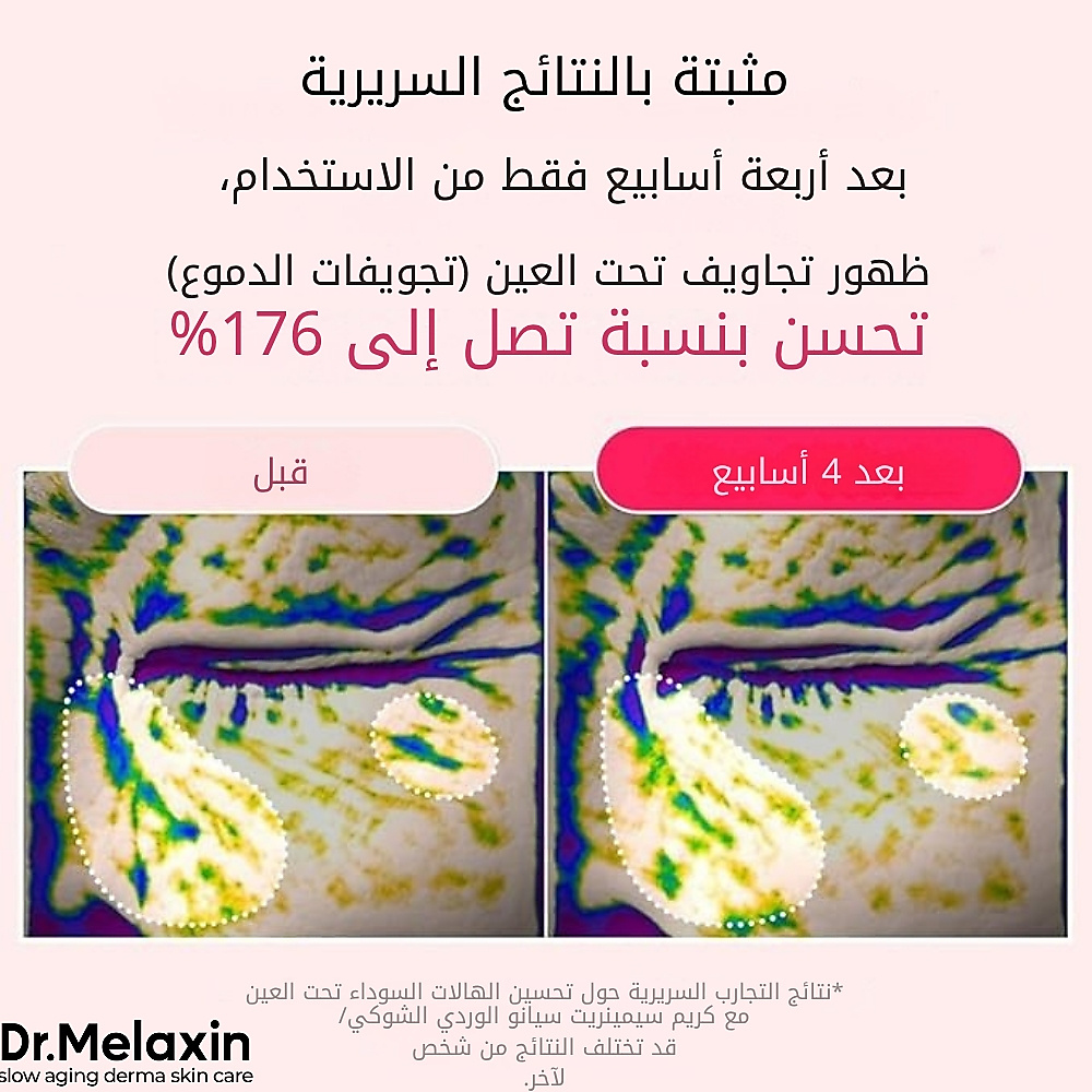 Cemenrete Cyano Pink Spicule Cream 50g
