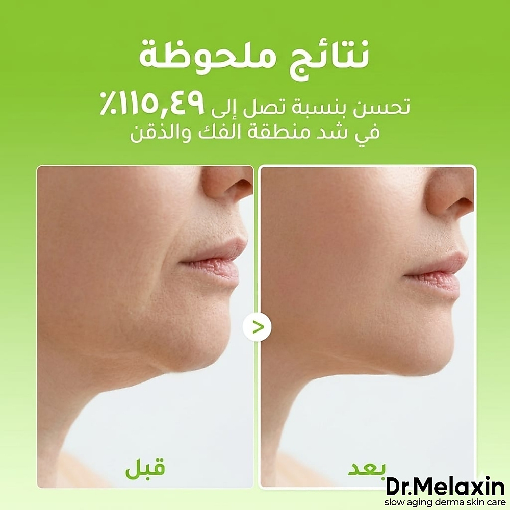 قناع رفع الذقن كاكتوس كولينق في اب (قطعة واحدة)