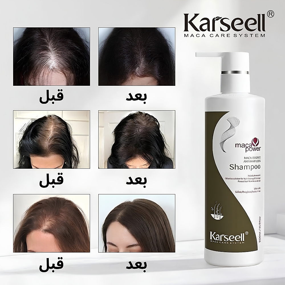 Karseell Anti- Hair Loss Conditioner 500ml