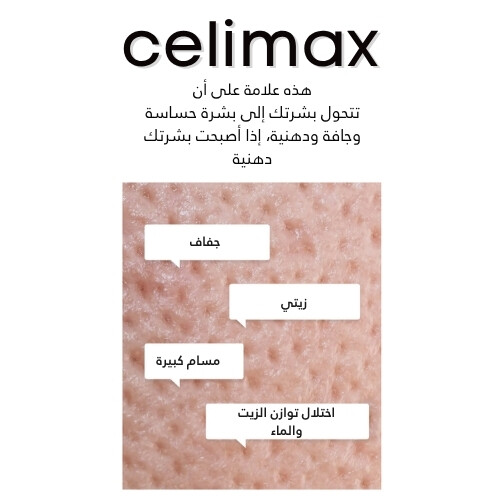 كريم مرطب للتحكم في الزيوت 80 مل