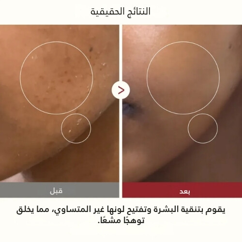 تونر الأرز الأبيض المتوهج بيل شوت 200 مل