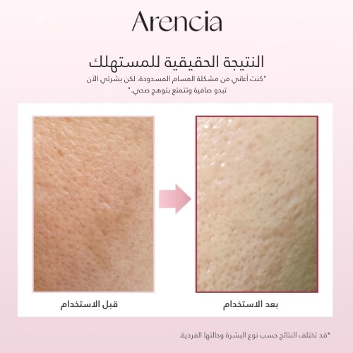 منظف ​​موتشي الأرز الطازج بخلاصة ثمر الورد 120 جرام