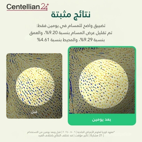 مسحوق شجرة الشاي ماديكا AC 6 جرام