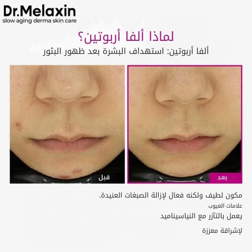 أمبولات سيمينريت بيكوتونيك شوت 30 مل