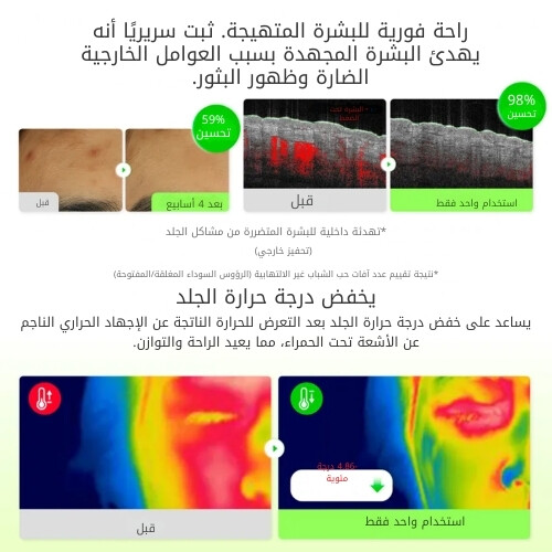 تونر مهدئ بخلاصة الصبار 150 مل