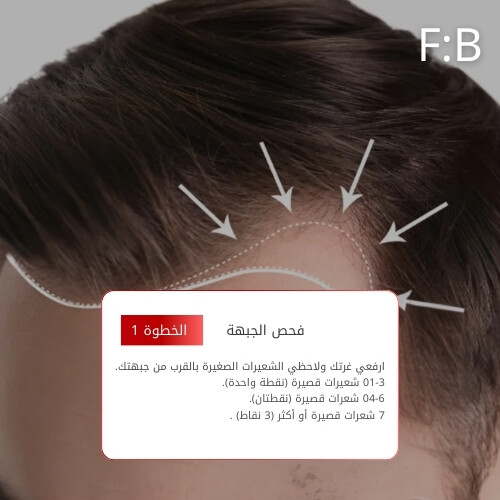 أمبولات فروة الرأس MTS 500 ريد بوست 10 مل