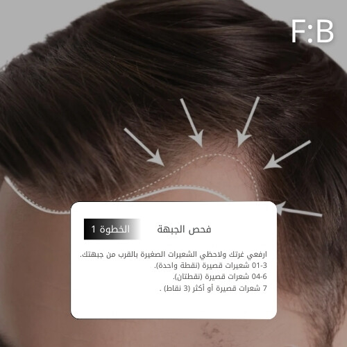 أمبولات فروة الرأس MTS 1000 بلاك بوست 10 مل