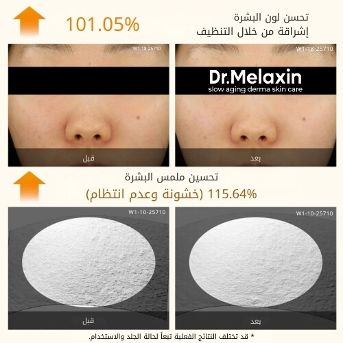 سيروم التقشير بحمض الكوجيك والكركم من بيل شوت